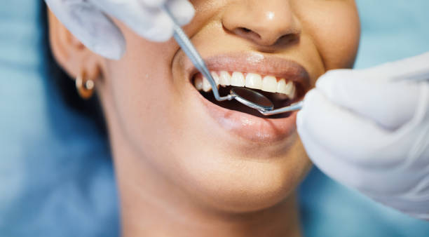 Best Emergency Dental Care for Broken or Chipped Teeth in Ho Ho Kus, NJ